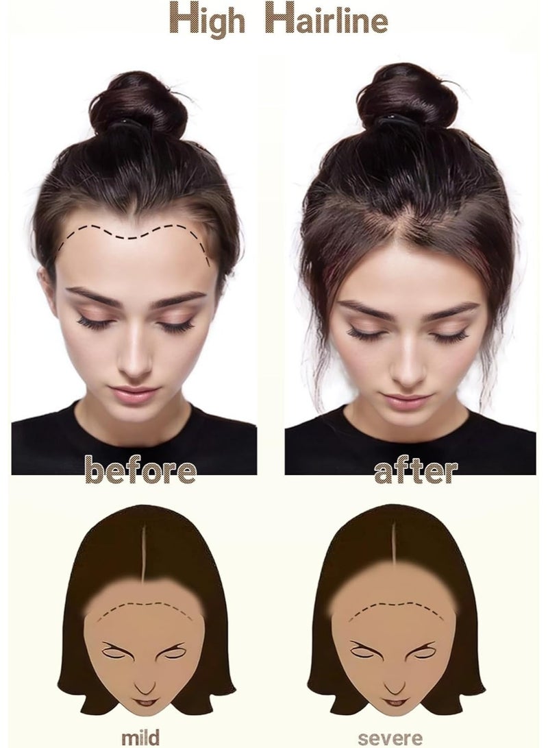 Estelle Hand Woven Invisible Biological Scalp Wig Piece Ladies Forehead Hairline Wig Patch Hair Piece Real Hair Natural Color - Image 5