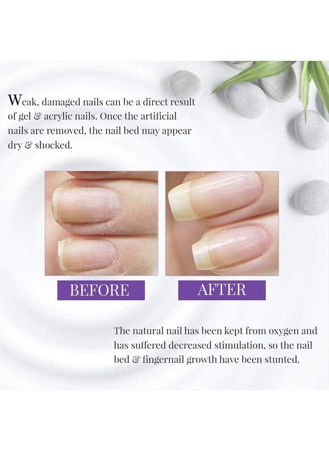 Foundation Xtra 4, Ridge Filling Strengthening Base Coat for Weak and Damaged Nails, 0.5 oz, 1-Pack