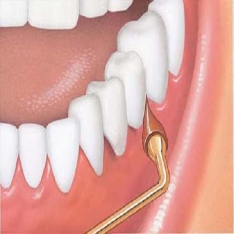 Gum محفز اللثة بمقبض دائم - جهاز تدليك بمقبض طويل لإزالة البلاك وتعزيز الصحة (مقبض + 2 عبوات إعادة تعبئة) - Image 2