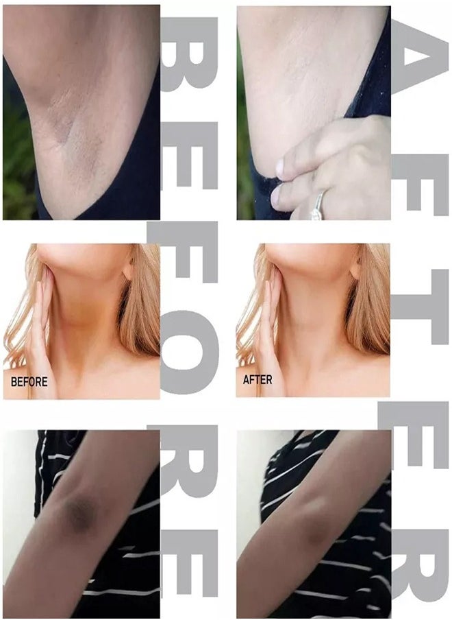 CARVENCHY - Niacinamide Dark Spot Removal Cream 50ML, Moisturize and Firm The Skin - Image 1