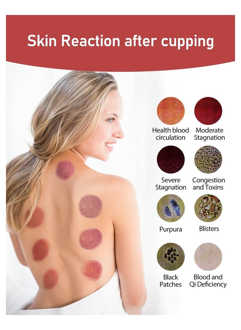 4 in 1 Cupping Therapy Set with 12 Massage Modes, Digital Electric Cupping Device for Effective Cellulite Removal, USB Rechargeable for Improving Your Health and Wellness - Image 5