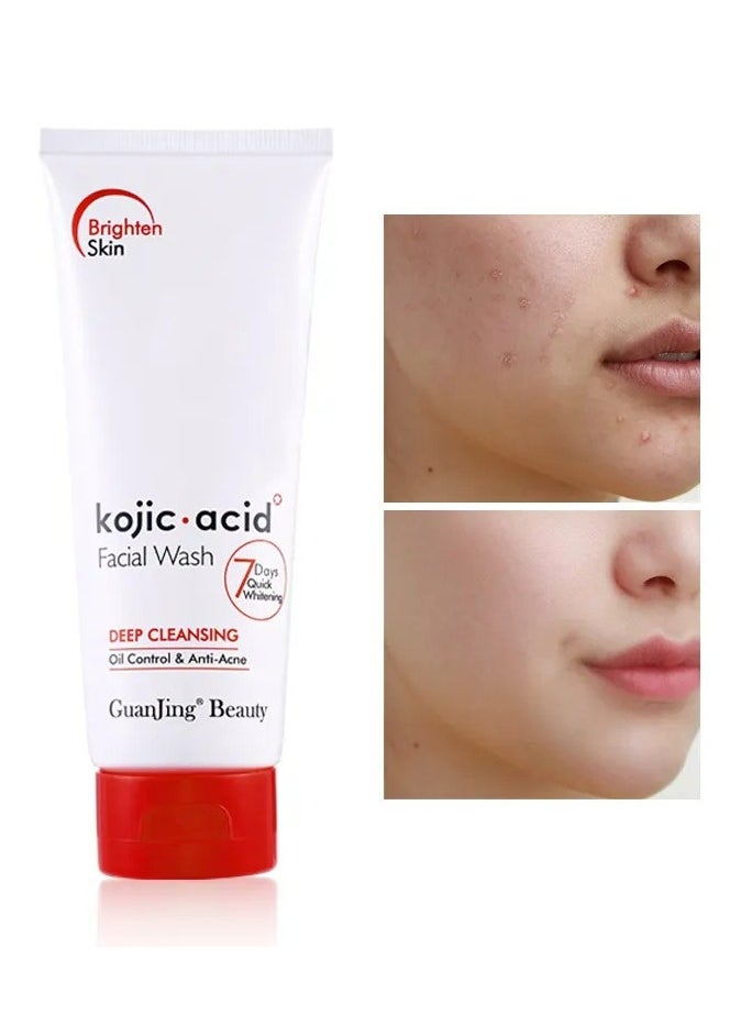 7 Days Whitening Kojic Acid Face Wash Deep Cleaning Oil Control Anti Acne Facial Cleanser 100g - pzsku/Z9309CA1FB731E067D89DZ/45/_/1734046488/dad49ca8-8d12-48cf-bb28-9f1b8265df62