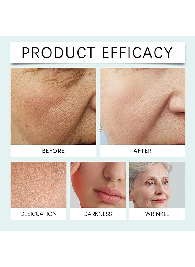 Hoygi Renewal Face Cream, Anti-Wrinkle Cream for Melasma and Freckles, Repair and Brighten Cream, Face Cream for All Skin Sypes - 50G - Image 3