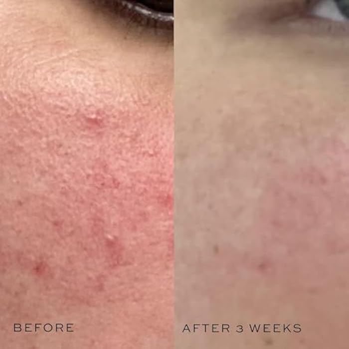 DIME Beauty Super Skin Toner, Alcohol-Free Witch Hazel Toner, Hydrating for Face with Aloe Vera and Cucumber Extract, 4 oz / 120 ml - Image 4