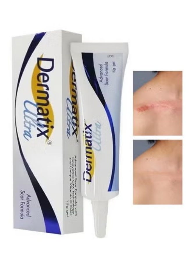 Dermatix Advanced Scar Formula, Scar Repair, Hypertrophic Scars Gel 15G - Image 2