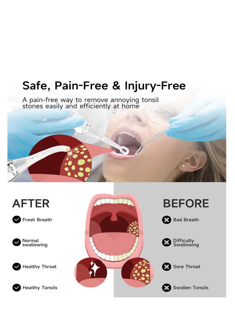 SYOSI Electronic Vacuum Tonsil Stone Remover Kit, 10-in-1 Mouth Cleaning Tool with 5 Suction Modes, Oral Fresh Care for Tonsil Stone Removal  - Image 2