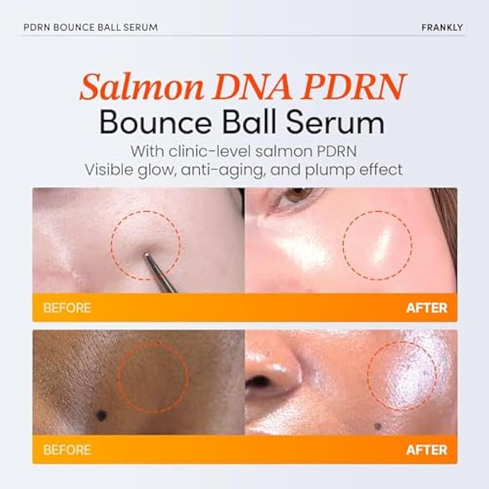 FRANKLY Salmon PDRN Bounce Ball Serum – Skin Repair PDRN Salmon DNA Serum for Post Microneedling Recovery, Redness & Damaged Skin | Glass Skin Korean Skincare | Lightweight, Non Sticky | 1.01 fl oz - Image 2