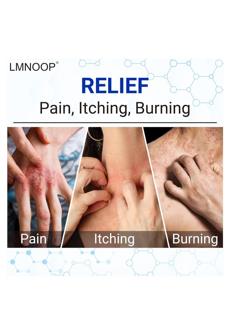 لمنوب Eczema Cream, Maximum Strength Therapeutic Ointment for Rashes, Psoriasis, Dermatitis, Urticaria, Tinea Foot, Jock Itch, Fungal Infection, Anti-Itch, Relieves Skin Sensitivity, Irritated 100g - Image 2