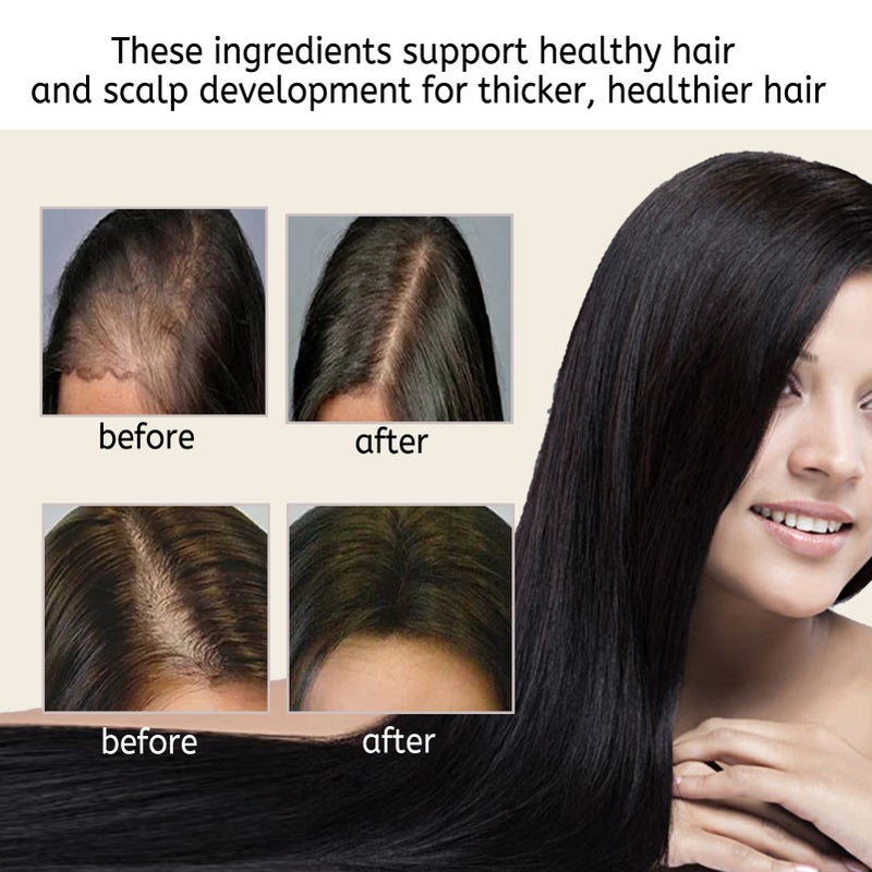 Anti-hair Loss Shampoo Bar 80g Natural Ingredients Support Thick Healthy Hair - Balance Oily Scalp Nourish Roots Rice Essence Hair Soap for Scalp & Hair Care - Image 5