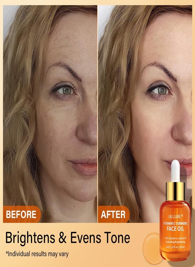 ulluxe Vitamin C Turmeric Face Oil, Brightening & Hydrating Facial Oil, Nourishing & Anti-Aging with Jojoba Oil & Squalane for Dark Spots, Dry Skin, Wrinkles & Uneven Skin Tone, for All Skin Types, 1 Fl Oz - Image 5