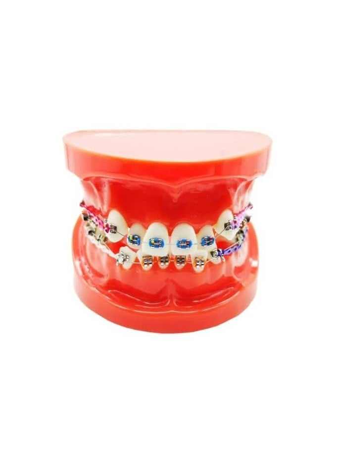 OrthoUnion Orthodontic Dental Demonstration Teeth Model Study Teaching Dental Model  - Image 1