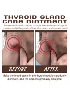 SOUTH MOON Thyroid Gland Care Cream Cream And Caused By Goiter 20g  - Image 3