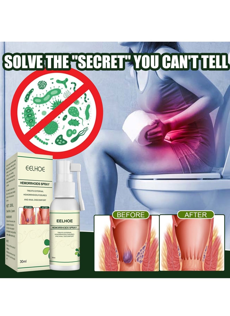 EELHOE 30ML Hemorrhoid Spray, Korean Natural Herbal Hemorrhoids Spray Pain Itch Relief, Hemorrhoid and Fissure Treatment, Hemmoroids Treatment Removal Spray (1pcs) - Image 5