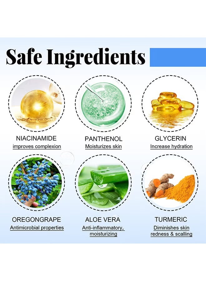 ساوث مون الصدفية الإغاثة رذاذ 30ML, كل علاج الأكزيما الطبيعية, علاج الصدفية, سريع تخفيف الحكة والاحمرار, العناية بالبشرة الألم الحكة العلاج رذاذ, سريع الإغاثة رذاذ للوجه والجسم - Image 3