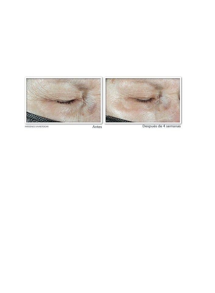 روك روك - كريم مرطب وملء العين متعدد الكوركسيون - 3 في 1 - يرفع ويشد محيط العين - مع حمض الهيالورونيك - 15 مل - Image 4