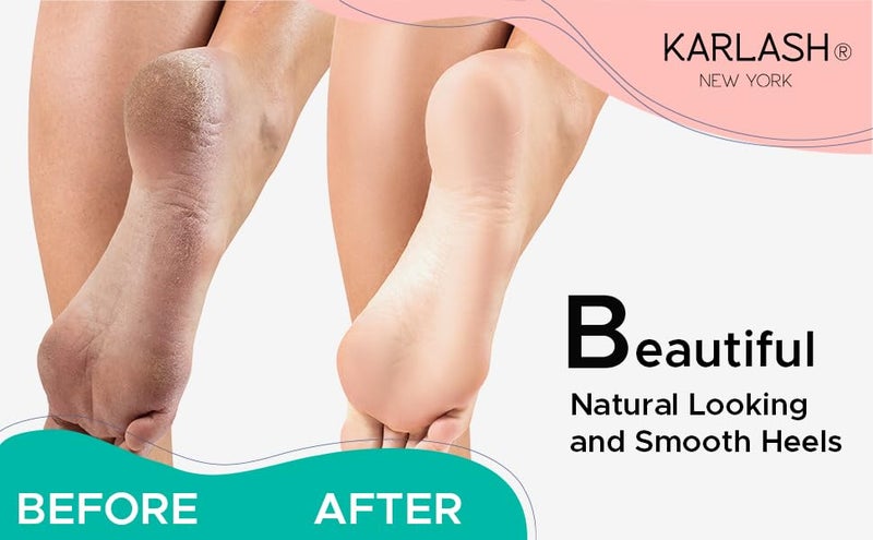 Karlash Callus Remover Gel for Feet and Foot Pumice Stone Scrubber Kit Remove Hard Skins Heels and Tough Callouses from feet Quickly and Effortless 4 oz (4 Ounce) - Image 3