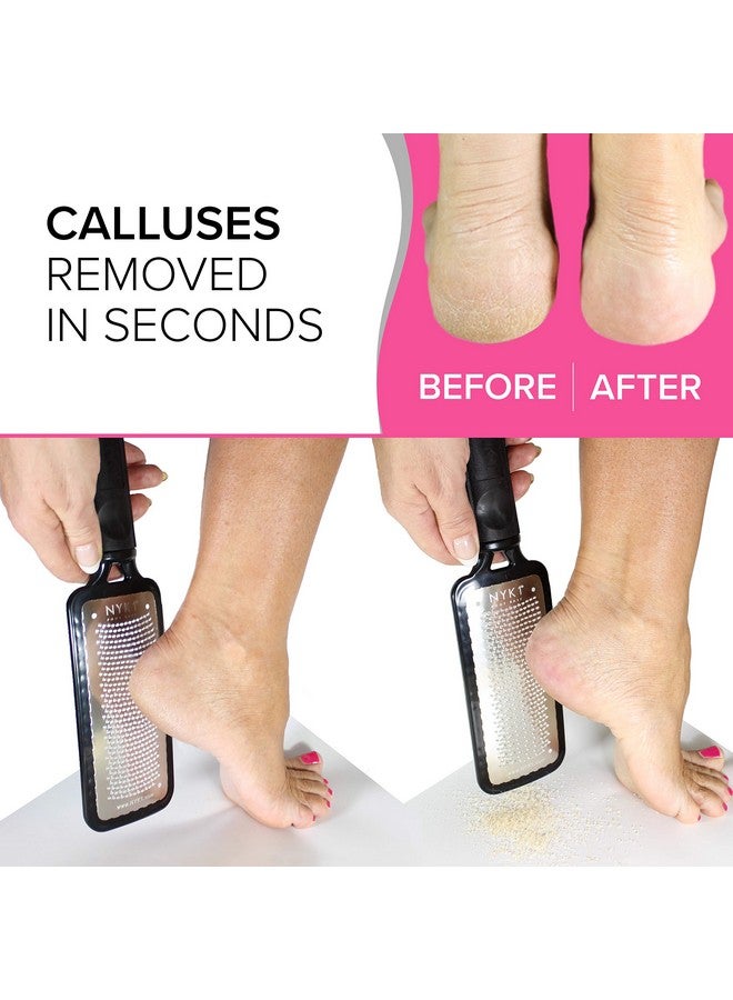 NYK1 Pedicure Rasp for Dry Hard Skin - EFFECTIVE Foot File GENUINE MEGAFILE Heel Care Callus Remover Dry Dead Skin Egg Corn Sander Scrubber Pumice Stone Alternative Ped Pedi Grater Files Add on Item - Image 2