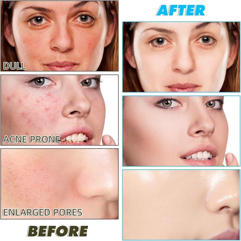 FARIOX Turmeric Kojic Acid Face Cleansing Pads for Dark Spots Skin Brightening Acne Prevention Vitamin C Retinol Chamomile Hydrolat For Women Men All Skin Type 60 Pieces Pack of 1 - Image 4