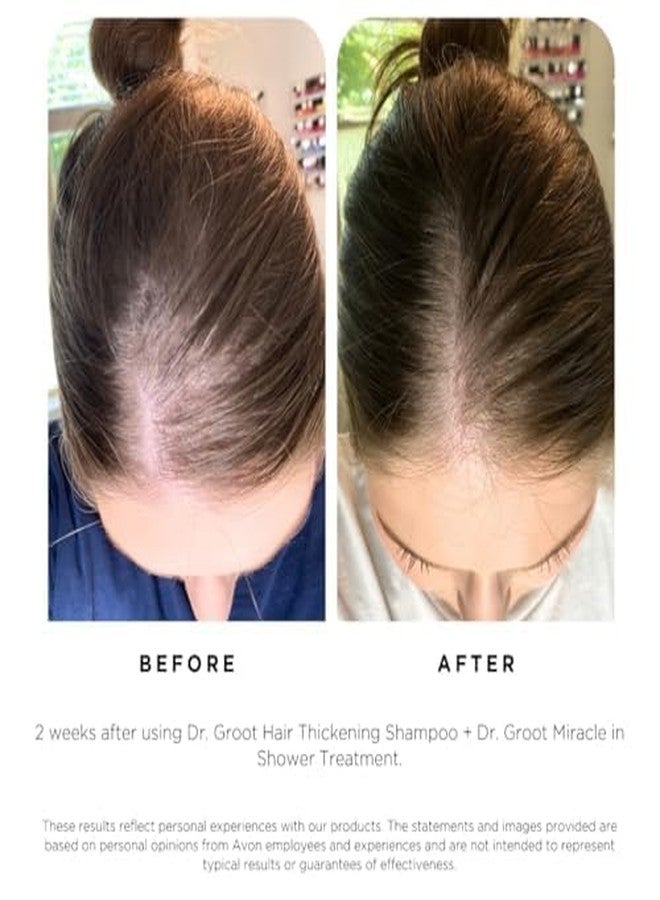 Dr.Groot Dr. Groot Hair Thickening Shampoo, Korean Hair Care with Biotin, Rosemary Oil to Help Volumize Thinning, Damaged Hair, Hydrate Hair and Scalp, Biotin Shampoo, Scalp Revitalizing Solution - Image 5