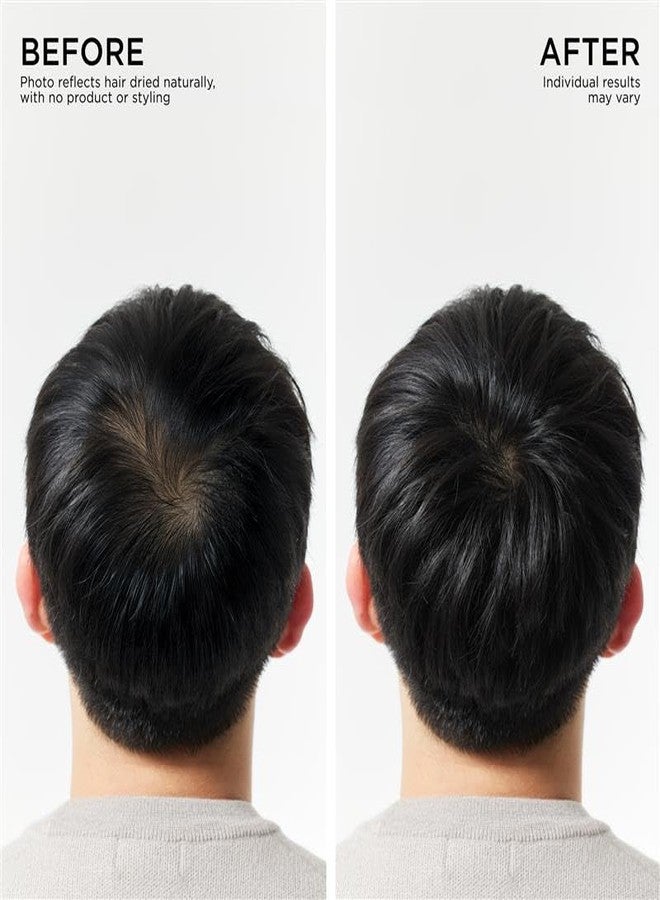 Dr.Groot Dr. Groot Hair Thickening Shampoo, Korean Hair Care with Biotin, Rosemary Oil to Help Volumize Thinning, Damaged Hair, Hydrate Hair and Scalp, Biotin Shampoo, Scalp Revitalizing Solution - Image 4
