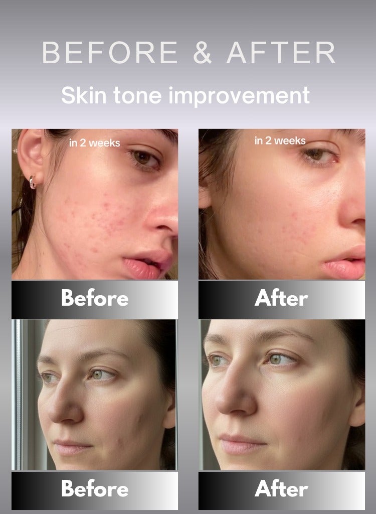 سيليماكس JIWOOGAE Cica BHA Blemish Toner Pad – وسادات التونر للتقشير والتهدئة للبشرة المعرضة لحب الشباب والحساسة – 60 وسادة - Image 3