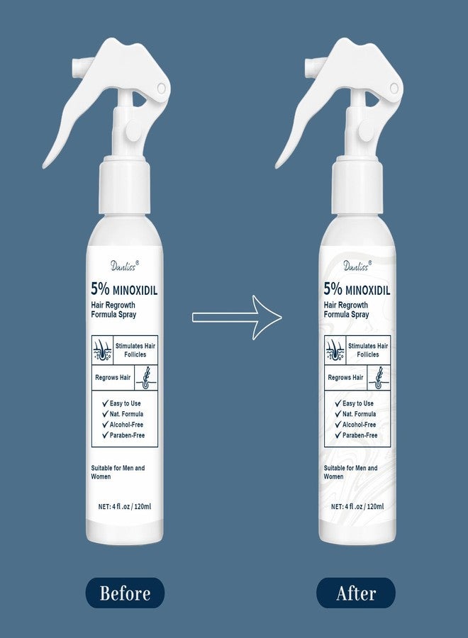 danliss 5% Minoxidil for Men and Women, Hair & Beard Growth Treatment with Biotin & Rosemary Growth Treatment for Thinning & Hair Loss - Extra Strength Minoxidil Hair Loss Serum 4 oz - Image 3