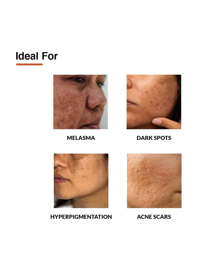 FIXDERMA Fixderma 10% Tranexamic Acid + 2% Kojic Acid + 1% Arbutin SKARFIX -TX Face Cream For Melasma | Pigmentation Removal Cream | Uneven Skin Tone, Help to Reduces Dark Spots and Blemishes - 30 gm  - Image 3