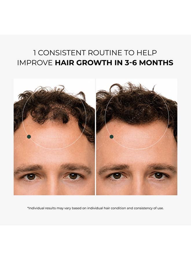 Green Wealth Neo Hair Lotion for Hair Loss Treatment | Hair Regrowth | Thinning, Bald Spots & Hair Fall | Trusted Formula with Ginseng, Saw Palmetto & Horsetail | 120ml - Image 3