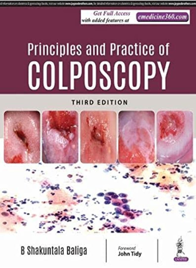 Principles and Practice of Colposcopy - pzsku/Z939459EB9F9BB6090AD0Z/45/_/1696237653/c261a413-568f-42d4-a6bc-be89f949b895