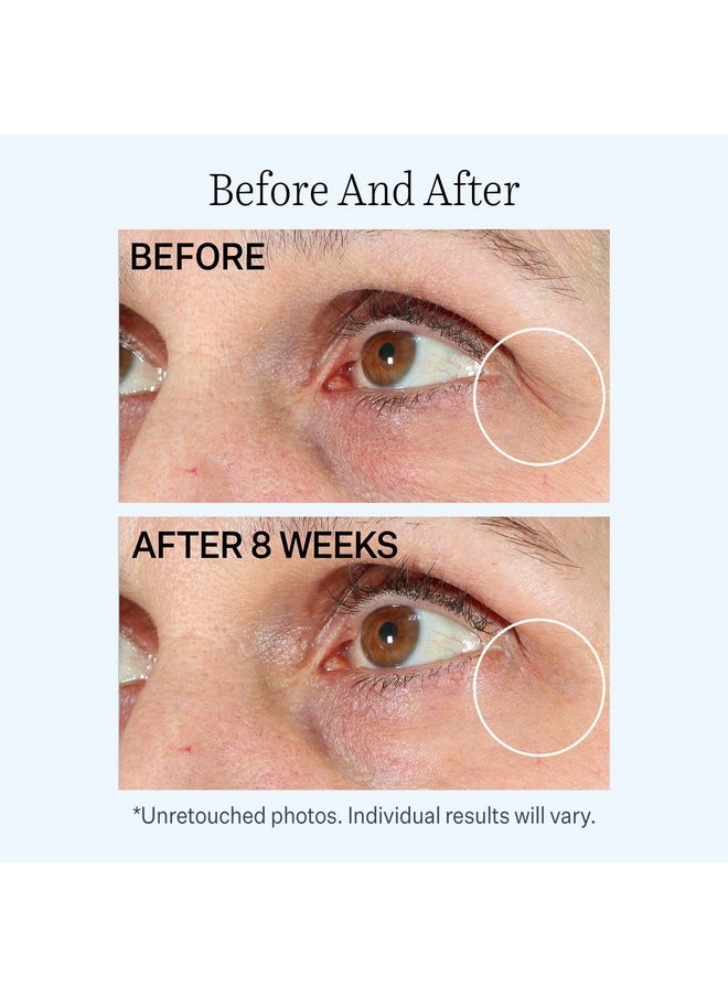 Strivectin - Contour Restore™ Firming Moisture Balm For Eyes 5 Oz - Image 1