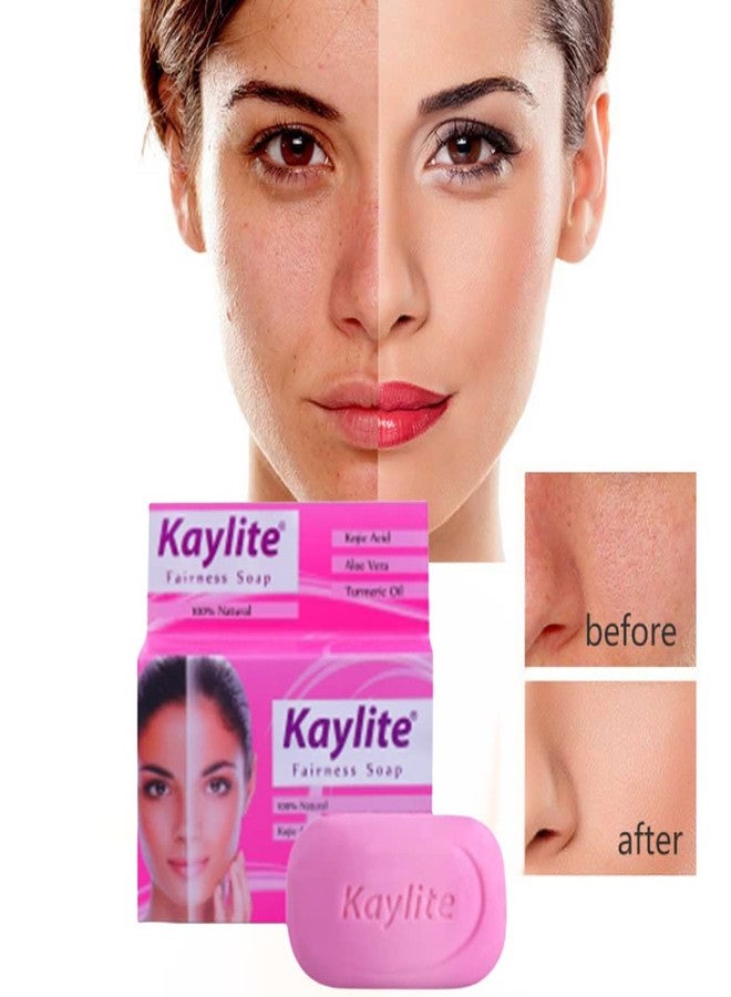 Kaylite Skin Whitening Face Soap 75 Gm with Kojic Acid, Aloe Vera | Turmeric Oil | Saumya Tandon Madam Ki Kaylite Cream and Face Soap Hai Combo Set(1 Soap + 1 Face Cream) - Image 5