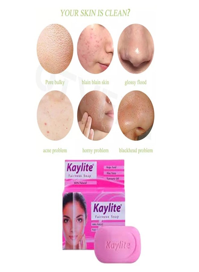 Kaylite Skin Whitening Face Soap 75 Gm with Kojic Acid, Aloe Vera | Turmeric Oil | Saumya Tandon Madam Ki Kaylite Cream and Face Soap Hai Combo Set(1 Soap + 1 Face Cream) - Image 2