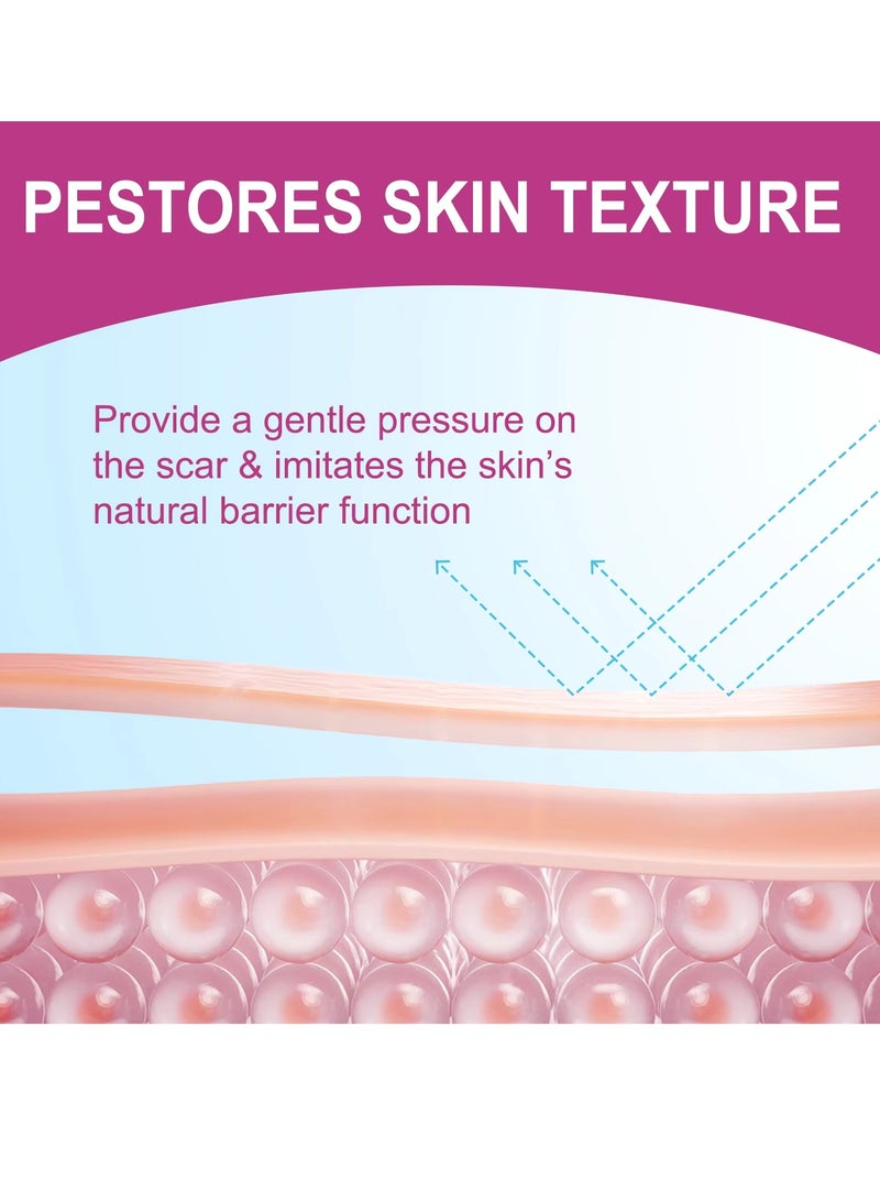 VOGSIG شرائح سيليكون لعلاج الندبات 1.9م شريط سيليكون طبي شفاف مطور لإزالة الندبات شرائط ندبات ناعمة قابلة لإعادة الاستخدام وغير مؤلمة لندبات العمليات القيصرية والحروق والكيلايد وحب الشباب والندبات الجراحية لجعل الندبات بعيدة عن الجسم والوجه - Image 3