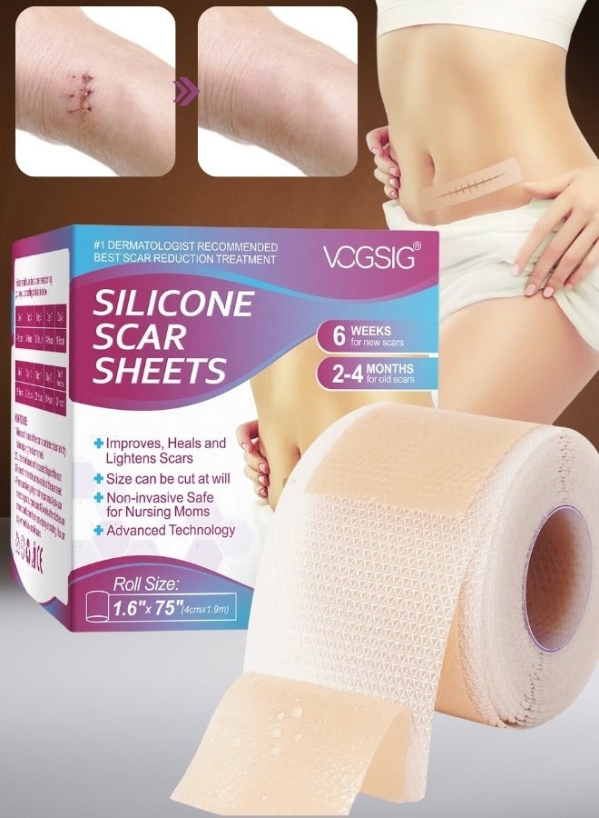 VOGSIG شرائح سيليكون لعلاج الندبات 1.9م شريط سيليكون طبي شفاف مطور لإزالة الندبات شرائط ندبات ناعمة قابلة لإعادة الاستخدام وغير مؤلمة لندبات العمليات القيصرية والحروق والكيلايد وحب الشباب والندبات الجراحية لجعل الندبات بعيدة عن الجسم والوجه - Image 1