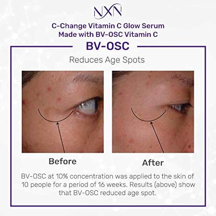 NxN Vitamin C & Hyaluronic Acid Serum Set, Clinically Proven to Brighten Skin, Reduce Dark Spots, Improve Hyper Pigmentation Age Spots, Reduce Fine Lines & Wrinkles - 1fl oz Face Kit - Image 4