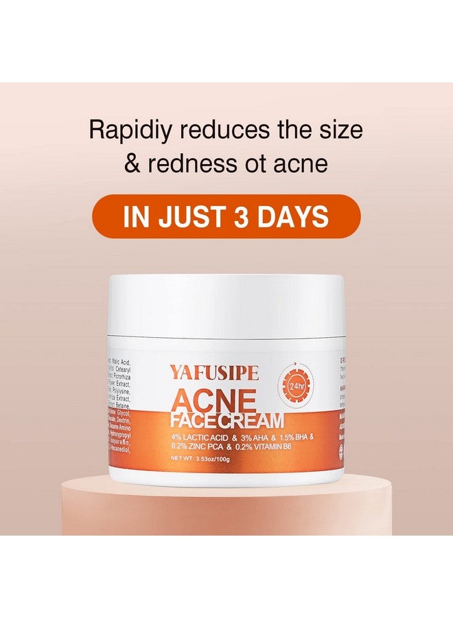 YAFUSIPE Acne Treatment for Face, Acne Cream Back Acne Treatment Cream for Teens & Adults Anti-acne Pimple Cream Butt Acne Clearing Cream, Acne Spot Treatment - Image 2