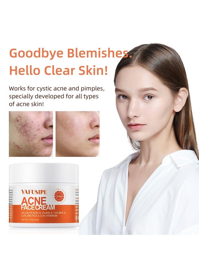 YAFUSIPE Acne Treatment for Face, Acne Cream Back Acne Treatment Cream for Teens & Adults Anti-acne Pimple Cream Butt Acne Clearing Cream, Acne Spot Treatment - Image 3