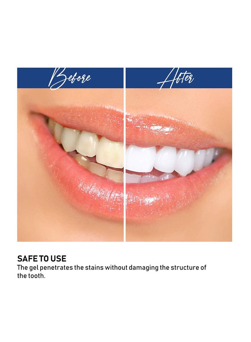Teeth Whitening Accelerator Light, 5X More Powerful Blue LED Light, Whiten Teeth Faster