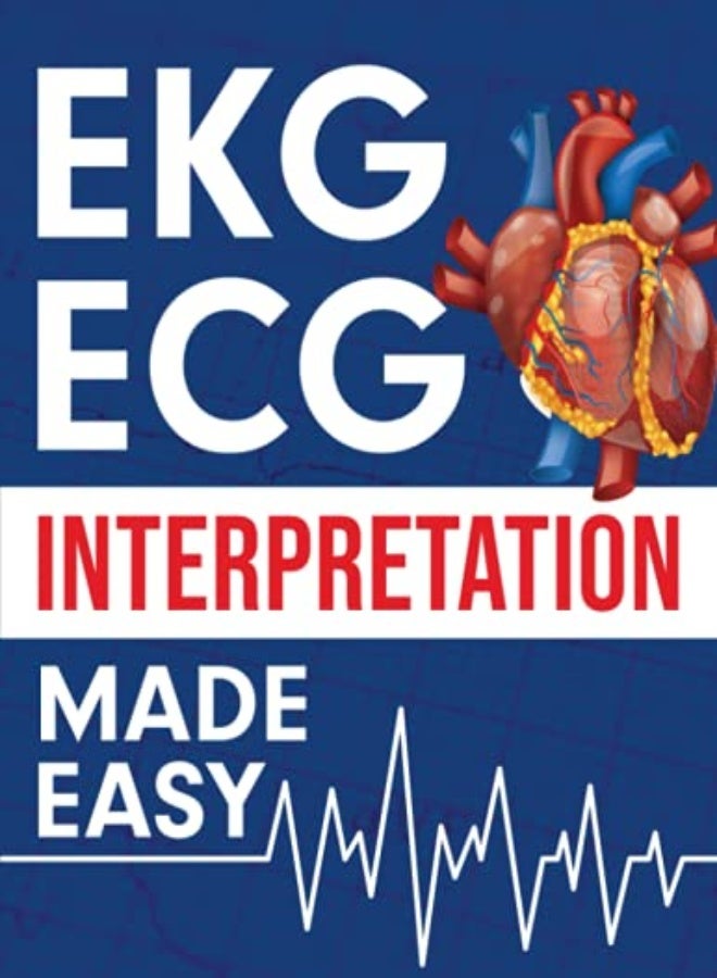 تفسير تخطيط القلب الكهربائي (EKG ECG) بسهولة
