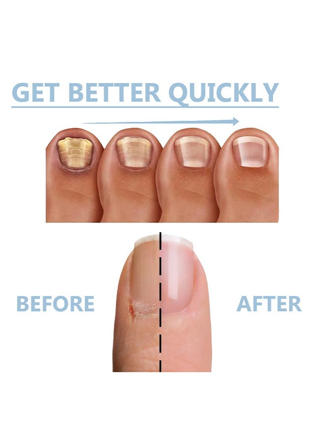 OceAura Nail Guard,Nail Growth and Repair Serum,Nail Repair Serum,Nail Strengthener for Damaged Nails,Nail Hardener for Growth and Strength 15ml - Image 5