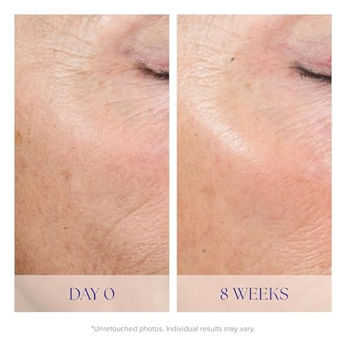 iS CLINICAL Active Peel System, two-step gentle at-home peel system for face Exfoliation - Image 5