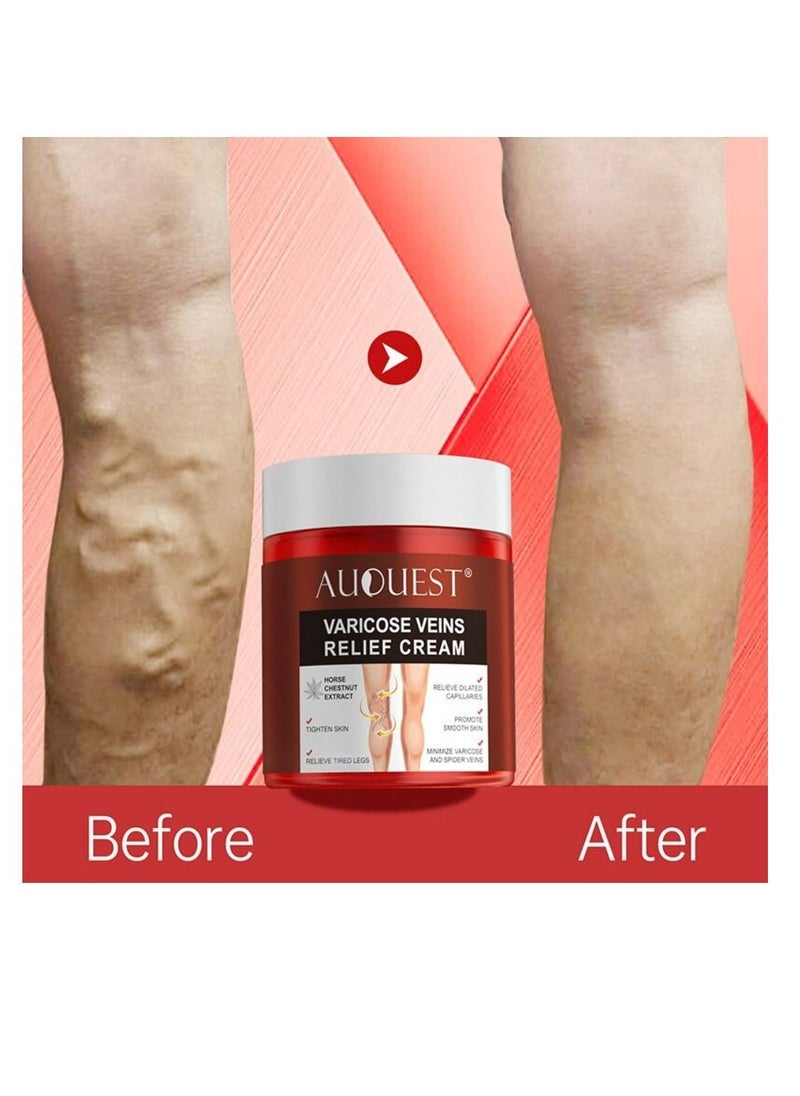 Spider Vein  and Varicose Veins Relief Cream Relief from Veins Disease aching pain, Drop, Swelling and Powerless 80g