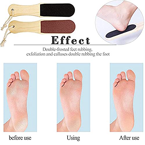 RIXTEC Double Sided Foot File Scrubber | Dead Skin & Callus Remover | Feet Scraper | Pedicure Tool with Wooden Handle - Image 2
