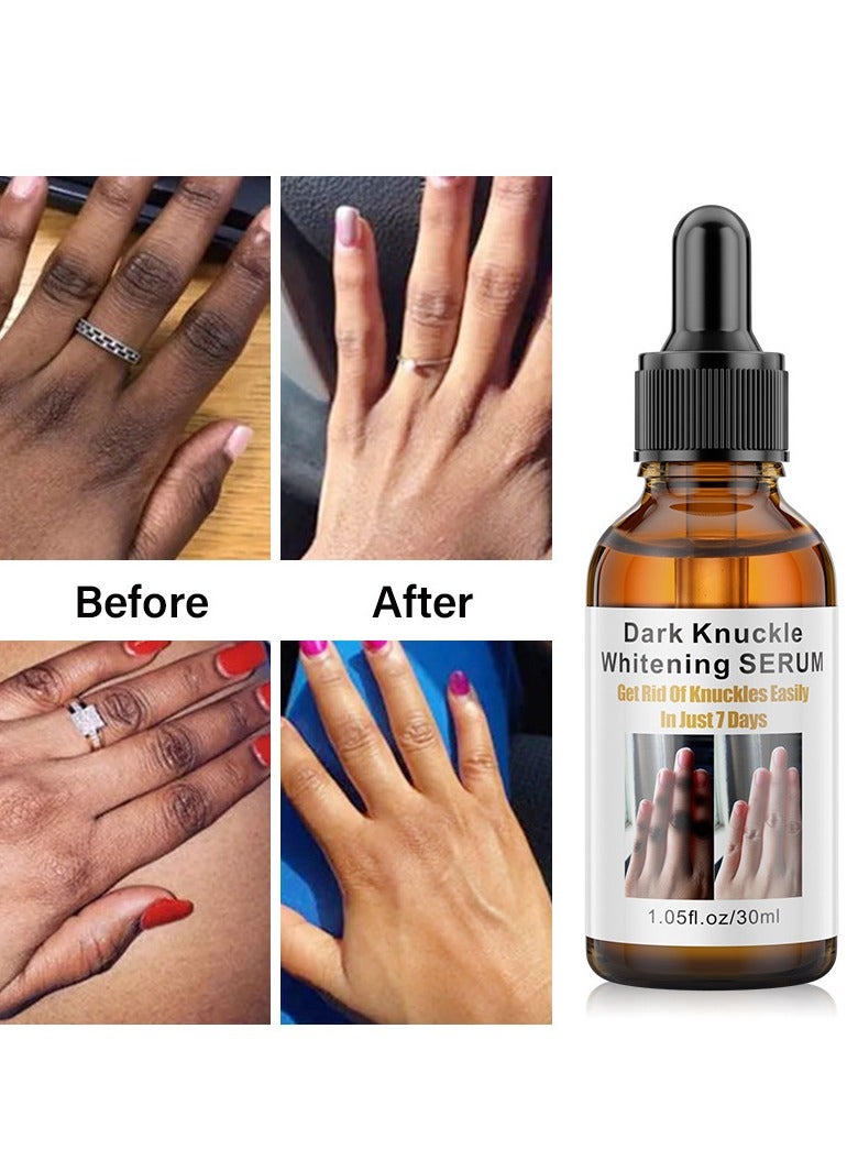 مويكا خلاصة سواد للركبتين والقدمين والمفاصل، خلاصة سواد وتفتيح للأصابع والمرفقين 30 مل - Image 4