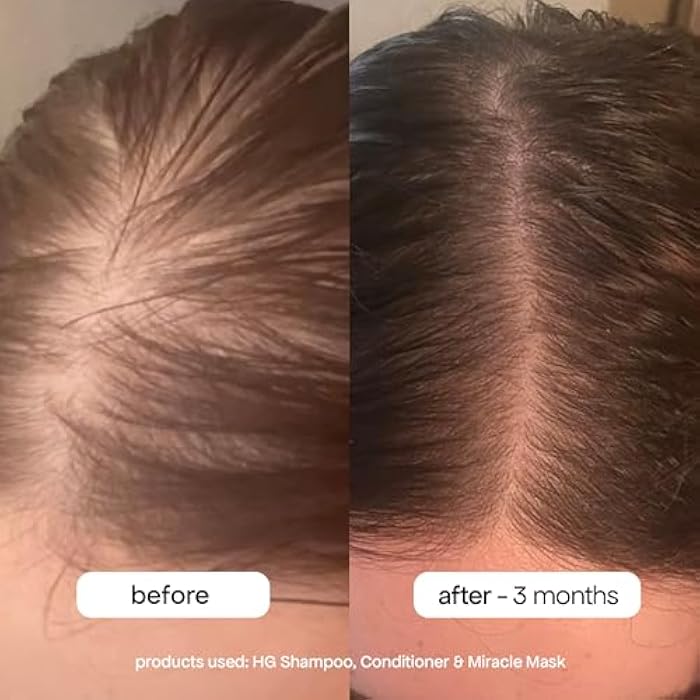BondiBoost HG Anti-Thinning Shampoo Conditioner Set [16.90 fl oz each], Clinically Tested to Promote Fuller + Thicker-Looking Hair for Women & Men, Procapil, Redensyl & Rosemary Formula, Sulfate-Free - Image 2