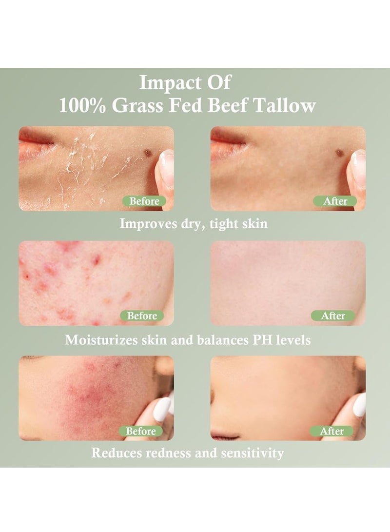 Beef Tallow Face Moisturizer, Unscented 100% Organic Grass-Fed Tallow, Whipped Face Cream & Body Lotion, Hydration & Skin Care for Sensitive Skin, 50g - Image 2
