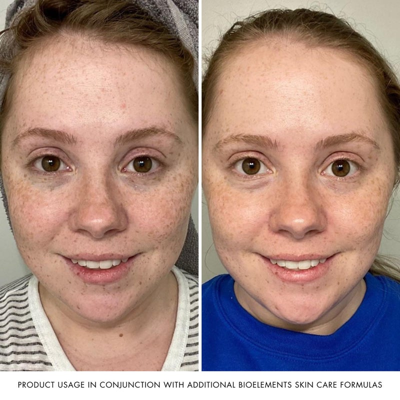 Bioelements Plump Start - 2 fl oz - Skin Plumping Serum to Improve Fullness & Smooth Fine Lines - Includes Collagen-4 Complex - All Skin Types - Vegan, Gluten Free - Never Tested on Animals - Image 5