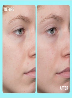 First Aid Beauty First Aid Beauty 10% Vitamin C Brightening Serum 50ml 1.7 FL oz.  - Image 3