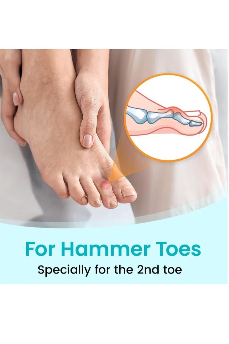 2PCS Fabric Hammertoe Pack, Hammertoe Corrector for Women and Men, Toe Splint for Curved Toes, Curled Toes, Bent Toes and Broken Toes, Toe Fixation Strap (Beige) - Image 3