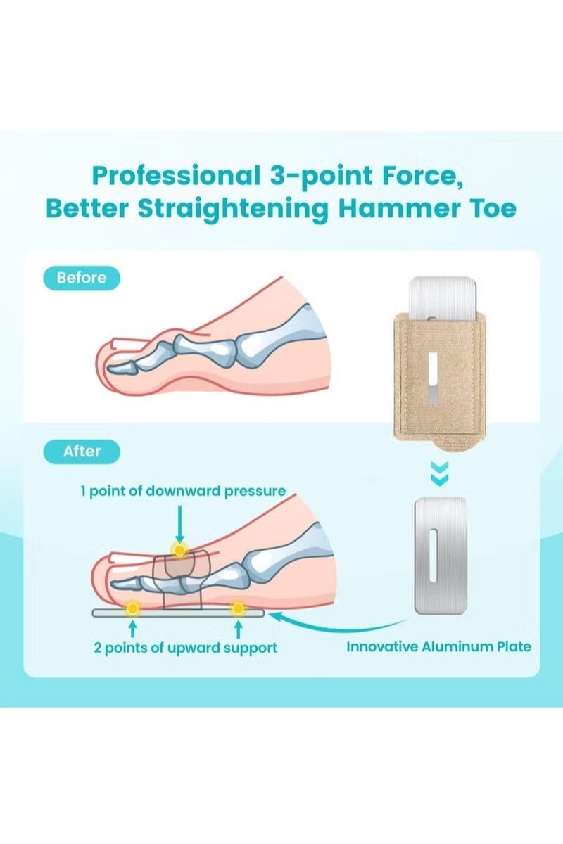 2PCS Fabric Hammertoe Pack, Hammertoe Corrector for Women and Men, Toe Splint for Curved Toes, Curled Toes, Bent Toes and Broken Toes, Toe Fixation Strap (Beige) - Image 4